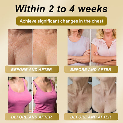 Official Online Offer | CLERALUXE® 🌞 ROYAL JELLY FIRMING & LIFT PATCH - Safe to use during breastfeeding – suitable for concerns such as underdeveloped breasts, sagging, flatness, skin creasing, and nipple pigmentation.